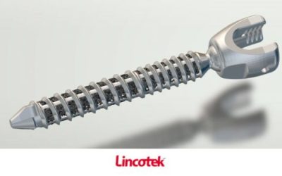Lincotek reçoit un brevet pour une vis orthopédique imprimée en 3D
